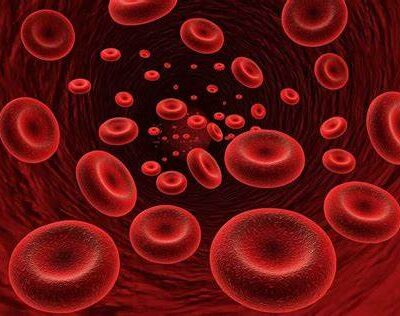 ANEMIA